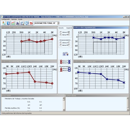 W50 Logiciel d’audiométrie