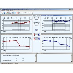 W50 Logiciel d’audiométrie